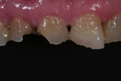 Fase pre operatoria, il paziente si presenta con questo sorriso