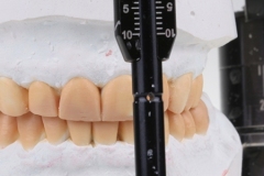 Trasferimento del smile design in ceratura diagnostica