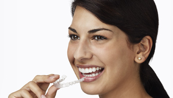 Vantaggi Apparecchio Invisalign