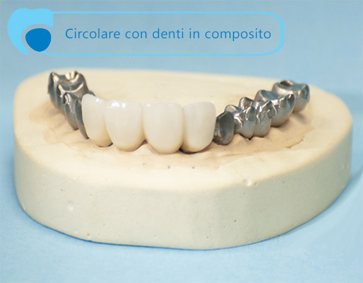 impantologia protesi