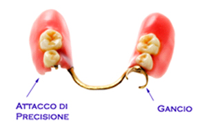 protesi precisione