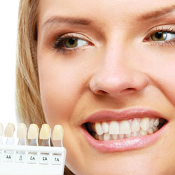 corone denti donna